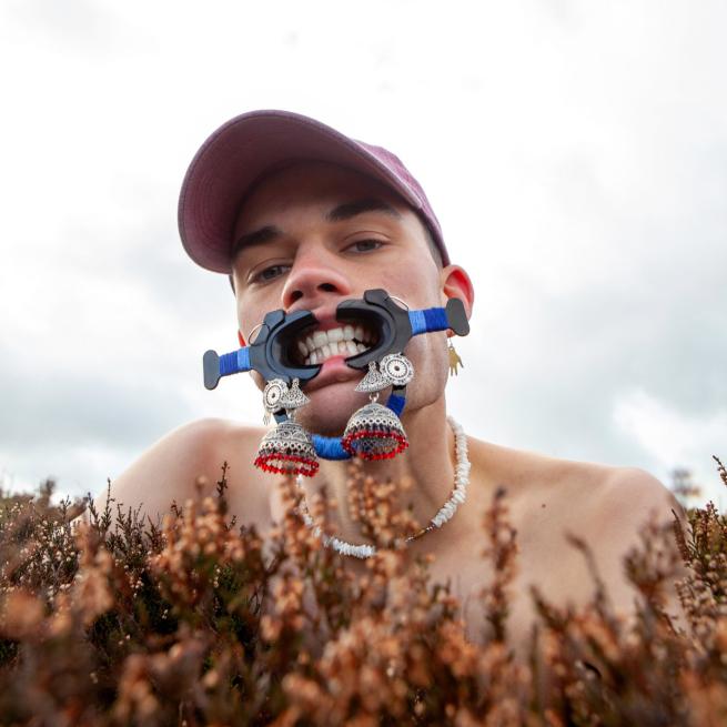 Head view of Herbie, shoulders up with a bush in front of him and under his head. He is wearing baseball cap and a device that stretches his lips to bare his teeth